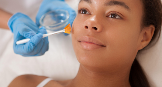 Still Avoiding Peels on Fitz IV–VI Skin? Read This First