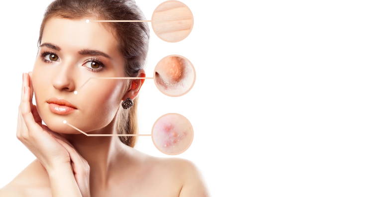 Does Probiotic Skincare Work?