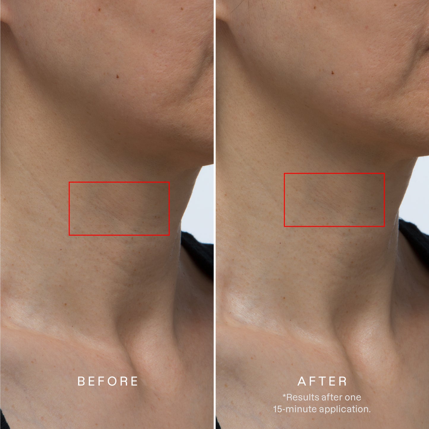 Karuna Collagen Hydrogel Neck & Décolleté Mask