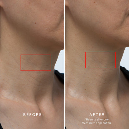 Karuna Collagen Hydrogel Neck & Décolleté Mask