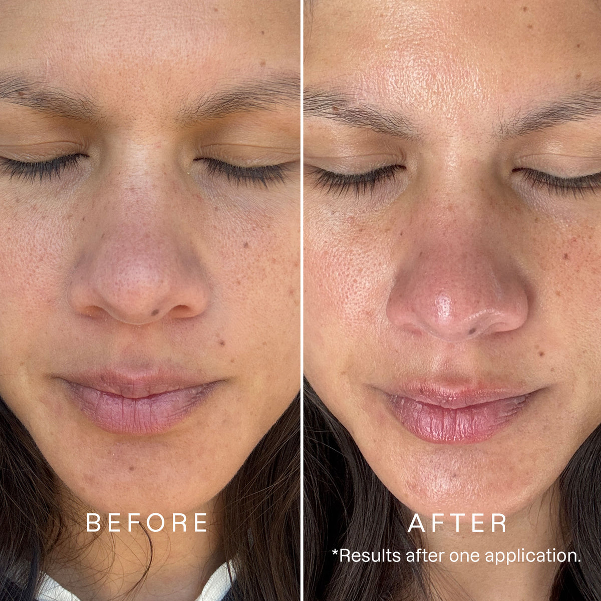 Karuna ProSkin Hyaluronic Acid Moisture Restore Mask