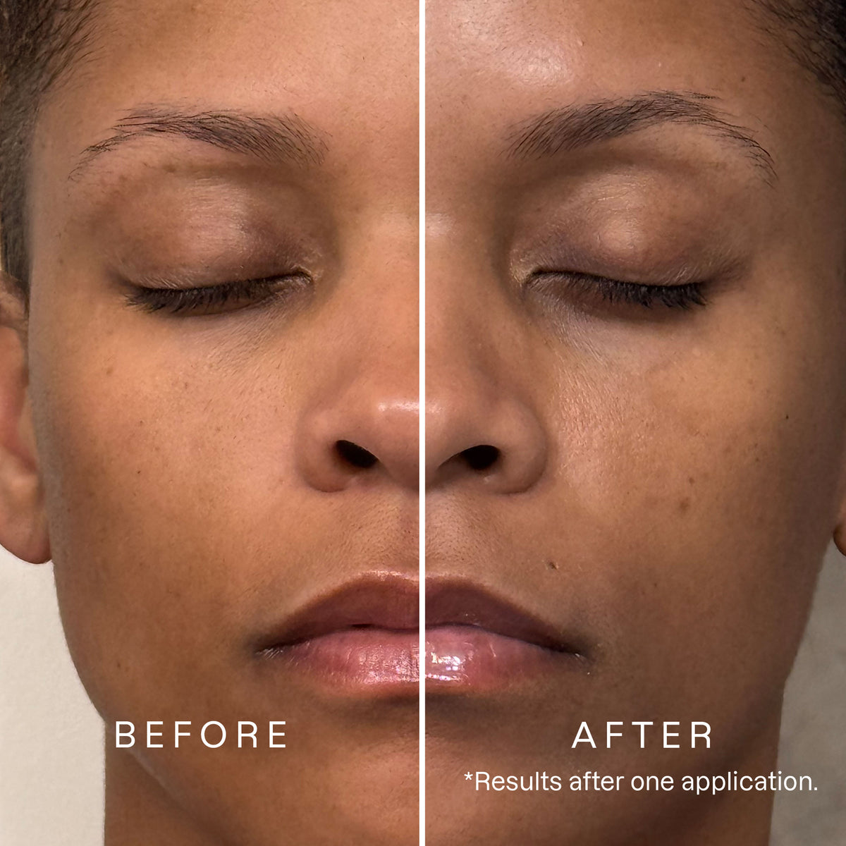 Karuna ProSkin Tranexamic Acid Radiance Revival Mask