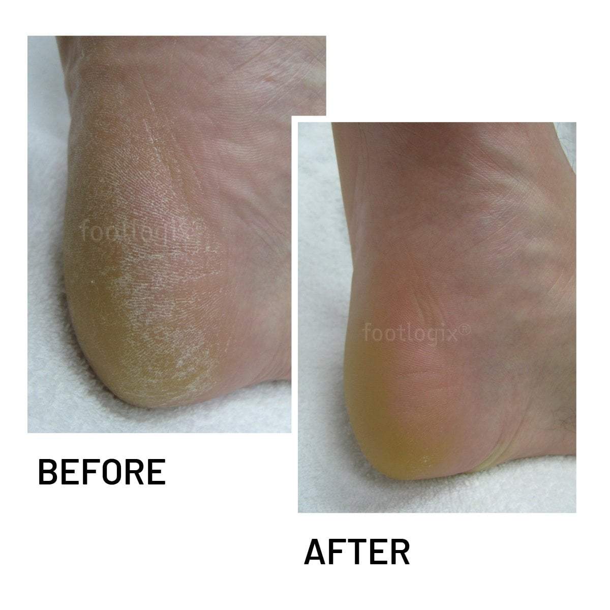 Footlogix Cracked Heel Formula 4.2oz Universal Companies