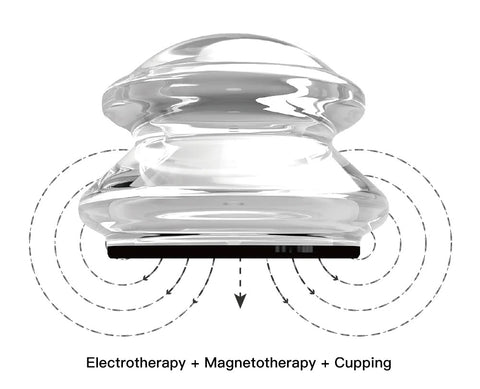 Image of Electromagnetic Cupping Therapy Kit